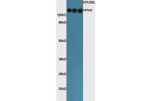 Lane 1: mouse lung lysates Lane 2: mouse liver lysates, Lane 3: mouse adrenal lysates probed with Rabbit Rabbit Anti-ACE Polyclonal Antibody, Unconjugated  at 1:5000 for 90 min at 37˚C. (Angiotensin I Converting Enzyme 1 anticorps  (AA 801-900))