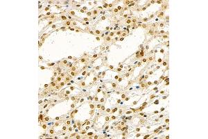 Immunohistochemistry of paraffin embedded mouse thymus using TCF7 (ABIN7075952) at dilution of 1:600 (400x lens)