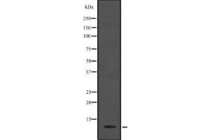 Western blot analysis of ANAPC13 expression in HEK293 cells ,The lane on the left is treated with the antigen-specific peptide. (ANAPC13 anticorps  (Internal Region))
