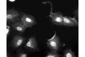 Immunofluorescent staining of U2OS (ATCC HTB-96) cells. (FAK anticorps  (AA 354-533))