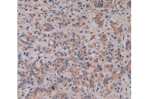Used in DAB staining on fromalin fixed paraffin- embedded prostate gland cancer tissue (MFAP2 anticorps  (AA 6-162))