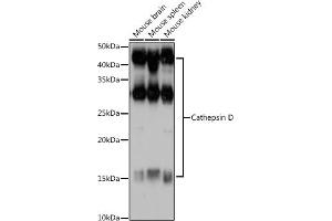 Western blot analysis of extracts of various cell lines, using Cathepsin D antibody (ABIN6127553, ABIN6139223, ABIN6139224 and ABIN6217233) at 1:1000 dilution. (Cathepsin D anticorps  (AA 65-412))