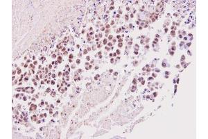 IHC-P Image Immunohistochemical analysis of paraffin-embedded SNU16 xenograft, using TIMELESS, antibody at 1:100 dilution. (TIMELESS anticorps  (N-Term))