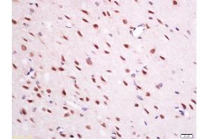 paraformaldehyde-fixed, paraffin embedded mouse brain tissue; Antigen retrieval by boiling in sodium citrate buffer(pH6) for 15min; Block endogenous peroxidase by 3% hydrogen peroxide for 30 minutes; Blocking buffer (normal goat serum) at 37°C for 20min; Antibody incubation with Rabbit Anti-QRFP Polyclonal Antibody, Unconjugated  at 1:200 overnight at 4°C, followed by a conjugated secondary and DAB staining (Neuropeptide anticorps  (AA 91-133))