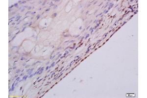 Formalin-fixed and paraffin embedded rat ovary labeled with Anti MSH3 Polyclonal Antibody, Unconjugated (ABIN1387851) at 1:200 followed by conjugation to the secondary antibody and DAB staining (MSH3 anticorps  (AA 521-620))