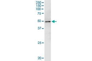 Immunoprecipitation of WAPAL transfected lysate using anti-WAPAL monoclonal antibody and Protein A Magnetic Bead , and immunoblotted with WAPAL monoclonal antibody.