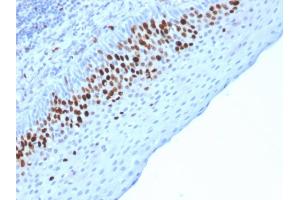Formalin-fixed, paraffin-embedded human Skin stained with Ki67 Mouse Monoclonal Antibody (MKI67/2463). (Ki-67 anticorps  (AA 2293-2478))