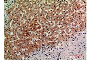 Immunohistochemical analysis of paraffin-embedded human-liver, antibody was diluted at 1:200