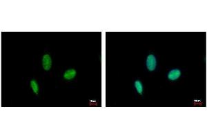 ICC/IF Image RAD23B antibody detects RAD23B protein at nucleus by immunofluorescent analysis. (RAD23B anticorps  (Center))