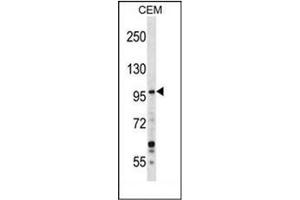 anti-Growth Regulation By Estrogen in Breast Cancer 1 (GREB1) (AA 1416-1446), (Middle Region) antibody