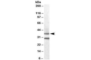 Western blot testing of mouse muscle lysate with MC5R antibody at 0. (MC5 Receptor anticorps)
