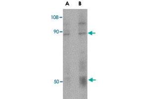 Western blot analysis of CD248 in human colon tissue lysate with CD248 polyclonal antibody  at (A) 0. (CD248 anticorps  (C-Term))