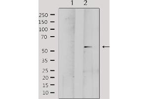 Western blot analysis of extracts from Hela, using MMP1 Antibody. (MMP1 anticorps  (C-Term))