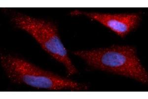 Immunofluorescence (IF) image for anti-Immunoglobulin Binding Protein (BIP) (AA 20-650) antibody (APC) (ABIN5566439) (BIP anticorps  (AA 20-650) (APC))