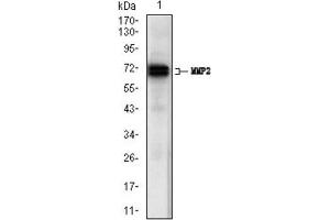 Western Blotting (WB) image for anti-Matrix Metalloproteinase 2 (MMP2) (AA 242-396) antibody (ABIN1844833) (MMP2 anticorps  (AA 242-396))
