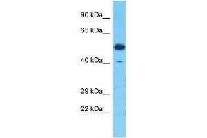 Host:  Rabbit  Target Name:  SERPINB3  Sample Type:  Thymus Tumor lysates  Antibody Dilution:  1. (SERPINB3 anticorps  (C-Term))