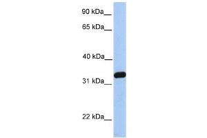 NKIRAS2 antibody used at 1 ug/ml to detect target protein. (NKIRAS2 anticorps  (C-Term))