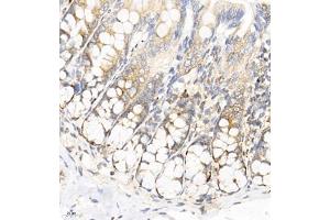 Immunohistochemistry of paraffin embedded rat colon using SEC238 (ABIN7075521) at dilution of 1:650 (400x lens) (Sec23 Homolog B anticorps)