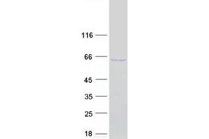Validation with Western Blot