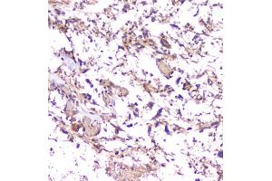 IHC-P: Amyloid beta antibody testing of mouse brain tissue. (APP anticorps  (C-Term))