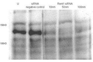 Total lysates (50 μg per lane) from Hela cells untransfected (U) or transfected with negative siRNA control or Rent1 siRNAs of 10nm, 50nm to 100nm. (RENT1/UPF1 anticorps  (AA 583-612))