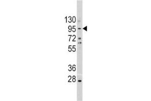 Western blot analysis of anti-E Cadherin antibody and A375 lysate