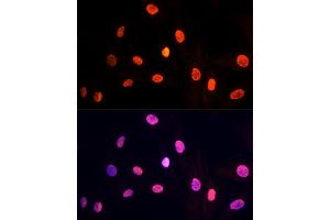 Immunofluorescence analysis of H9C2 cells using PRP19 antibody (ABIN6132438, ABIN6146256, ABIN6146258 and ABIN6216277) at dilution of 1:100 (40x lens).