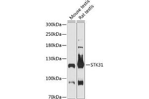 Western blot analysis of extracts of various cell lines, using STK31 antibody (ABIN6132843, ABIN6148608, ABIN6148609 and ABIN6216974) at 1:3000 dilution. (STK31 anticorps  (AA 890-1019))
