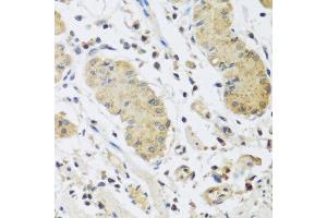 Immunohistochemistry of paraffin-embedded human stomach using IL4 antibody at dilution of 1:100 (40x lens). (IL-4 anticorps)