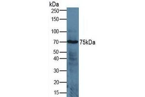 Rabbit Detection antibody from the kit in WB with Positive Control:  Sample Human jurkat cells. (ADAM17 Kit ELISA)