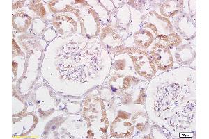 Formalin-fixed and paraffin embedded rat kidney labeled with Anti-TRADD Polyclonal Antibody, Unconjugated (ABIN673314) at 1:200 followed by conjugation to the secondary antibody and DAB staining.