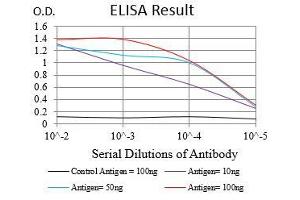 anti-Zinc Finger E-Box Binding Homeobox 1 (ZEB1) (AA 967-1108) antibody