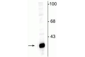 Western blot of rat hippocampal lysate showing specific immunolabeling of the ~32 kDa DARPP protein. (DARPP32 anticorps  (N-Term))