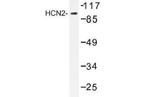 Image no. 1 for anti-Hyperpolarization Activated Cyclic Nucleotide-Gated Potassium Channel 2 (HCN2) antibody (ABIN317931) (HCN2 anticorps)
