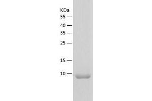 Western Blotting (WB) image for Adenylate Cyclase Activating Polypeptide 1 (Pituitary) (ADCYAP1) (AA 1-97) protein (His tag) (ABIN7121715) (PACAP Protein (AA 1-97) (His tag))
