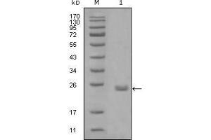 Western blot analysis using AXL mouse mAb against truncated Trx-AXL recombinant protein (1). (AXL anticorps  (AA 466-530))