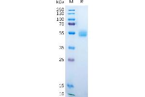 Human A Protein, hFc Tag on SDS-PAGE under reducing condition.