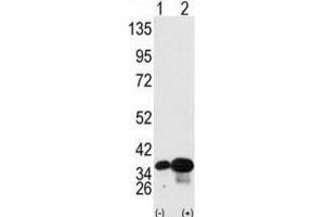 Western Blotting (WB) image for anti-Prohibitin 2 (PHB2) antibody (ABIN3003101)