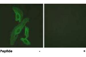 Immunofluorescence analysis of HeLa cells, using BCL2L1 polyclonal antibody .