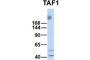 Host:  Rabbit  Target Name:  TAF1  Sample Type:  Human Fetal Liver  Antibody Dilution:  1. (TAF1 anticorps  (Middle Region))