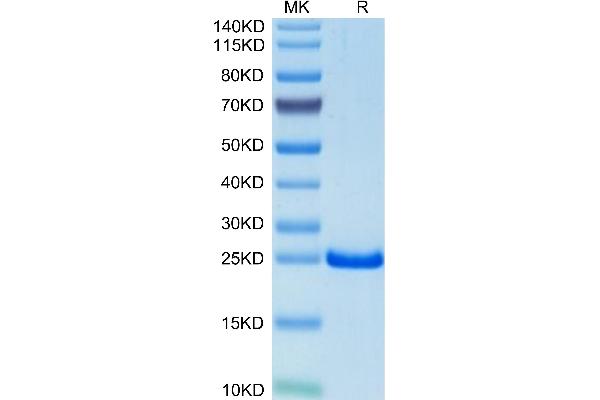TIMP2 Protein (AA 27-220) (His tag)