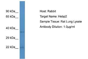 Host: Rabbit Target Name: HEBP2 Sample Tissue: Rat Lung Antibody Dilution: 1ug/ml (HEBP2 anticorps  (N-Term))