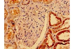 Immunohistochemistry of paraffin-embedded human kidney tissue using ABIN7175121 at dilution of 1:100