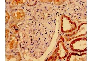 Immunohistochemistry of paraffin-embedded human kidney tissue using ABIN7175121 at dilution of 1:100