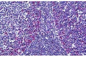 Human Tonsil: Formalin-Fixed, Paraffin-Embedded (FFPE) (FANCA anticorps  (AA 1121-1170))