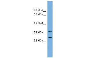 WB Suggested Anti-ZRANB2 Antibody Titration:  0. (ZNF265 anticorps  (Middle Region))