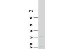 Validation with Western Blot