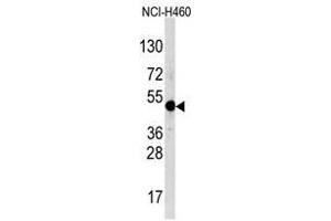 Image no. 1 for anti-Transcription Factor AP-2 alpha (Activating Enhancer Binding Protein 2 Alpha) (TFAP2A) (C-Term) antibody (ABIN357337) (TFAP2A anticorps  (C-Term))