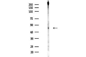 anti-Sirtuin 2 (SIRT2) (pSer368) antibody