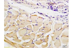 Formalin-fixed and paraffin embedded rat skin tissue labeled with Anti CTHRC1 Polyclonal Antibody, Unconjugated (ABIN759281) at 1:200 followed by conjugation to the secondary antibody and DAB staining (CTHRC1 anticorps  (AA 31-130))